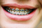 Smile